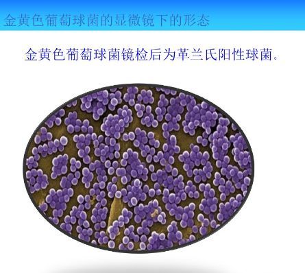常见微生物菌落形态特征详解
