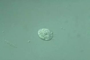 24种污水处理微生物菌相及应用指导深度解析